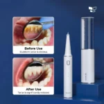 XIAOMI SUNUO T12 Pro Ultrasonic Dental Oral Teeth Cleaner Removal Whitening